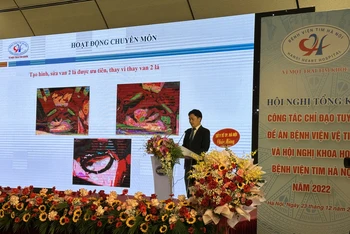 Đại diện Bệnh viện Tim Hà Nội báo cáo kết quả hoạt động trong năm 2022.