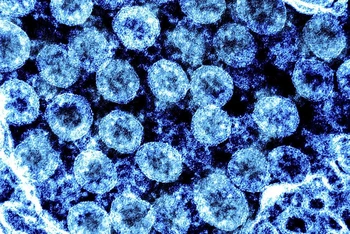 Hình ảnh từ kính hiển vi virus SARS-CoV-2 trong mẫu bệnh phẩm của bệnh nhân mắc Covid-19. (Ảnh: AFP/TTXVN)