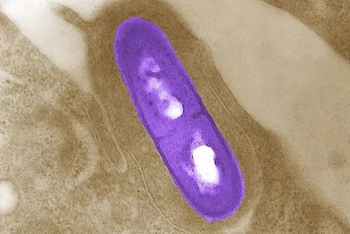 Vi khuẩn Listeria. (Ảnh: Reuters/TTXVN)