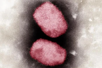 Virus đậu mùa khỉ nhìn dưới kính hiển vi. (Ảnh: AFP/TTXVN)