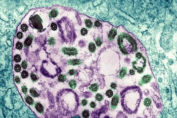 Hình ảnh dưới kính hiển vi điện tử của virus Marburg. (Ảnh: BSIP/UIG/Getty Images)