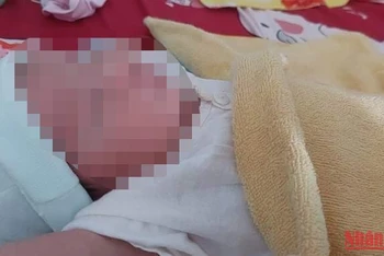 Em bé hoàn toàn âm tính dù mẹ nhiễm HIV.
