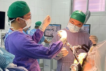 Các bác sĩ phẫu thuật đặt điện cực kích thích não sâu cho bệnh nhân.