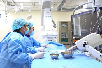 Ê-kíp bác sĩ nút mạch để bít tắc điểm rò động tĩnh mạch màng cứng xoang hang.
