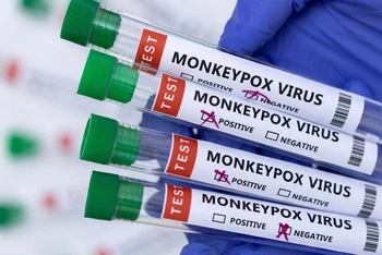 Ống đựng mẫu bệnh phẩm dương tính với virus gây bệnh đậu mùa khỉ. (Ảnh: Reuters)