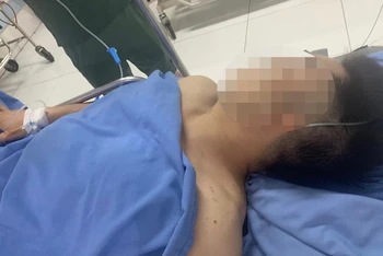 Thiếu tá Dương Xuân Kiệm bị trọng thương phải đưa vào bệnh viện cấp cứu.