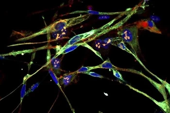 Tế bào Rhabdomyosarcoma biến đổi thành tế bào cơ. Ảnh: Phòng thí nghiệm Cold Spring Harbor.