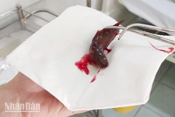 Con cá rô được bác sĩ gắp ra khỏi họng của người đàn ông. (Ảnh: Trung tâm Y tế huyện Giồng Riềng)
