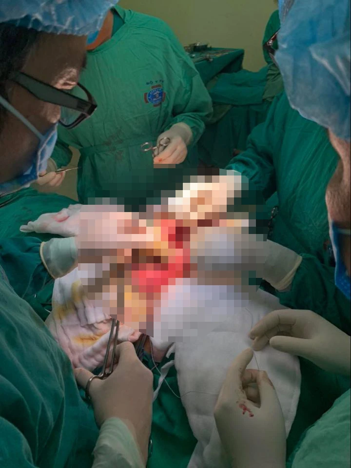 Lần đầu tiên thay xương bả vai cho bệnh nhi nhỏ tuổi nhất Việt Nam -0