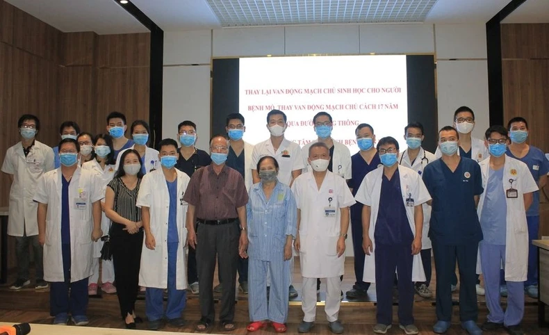 Bệnh nhân đầu tiên tại Việt Nam được thay lại van tim nhân tạo bị thoái hóa -0