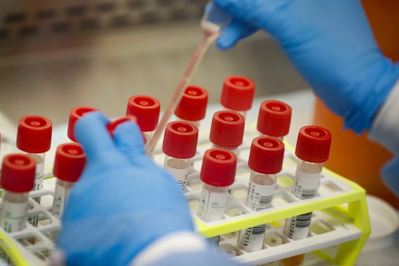 New York có kế hoạch tiêm vaccine ngừa Covid-19, Mỹ phê duyệt bộ xét nghiệm tại nhà -0