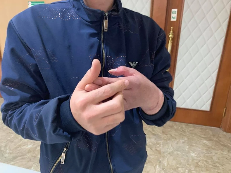 Cuộc sống mới của người đàn ông Việt Nam đầu tiên được ghép tay -0