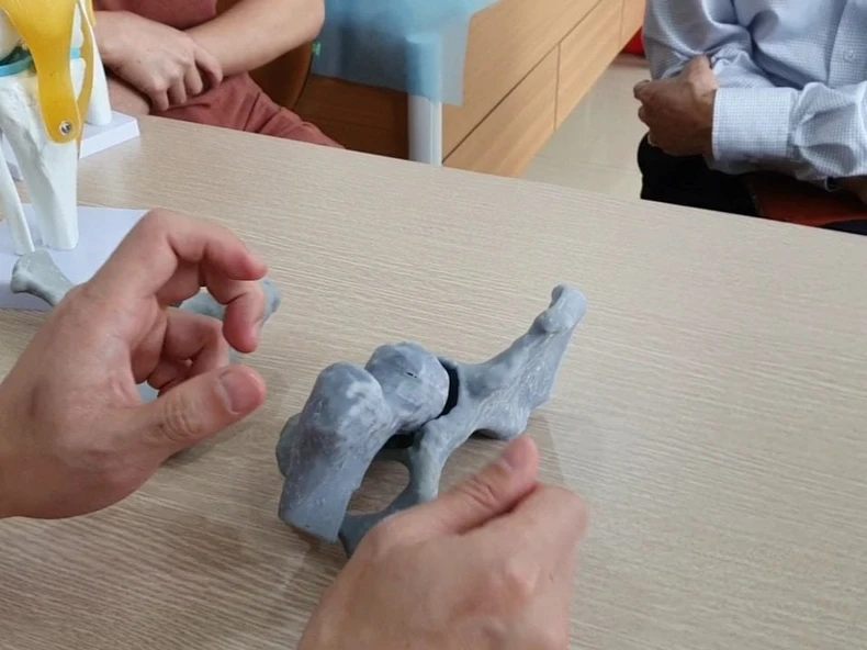 Lần đầu tiên, Việt Nam thực nghiệm phẫu thuật bằng công nghệ 3D -0