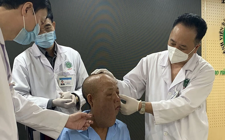 Phẫu thuật cho người đàn ông có khối u kỳ dị trên mặt -0