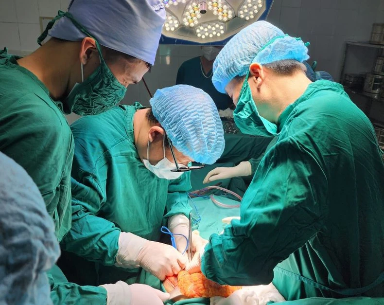 Bệnh viện tuyến huyện ở Thái Bình phẫu thuật thành công ca cắt đại tràng cho bệnh nhân K ảnh 2