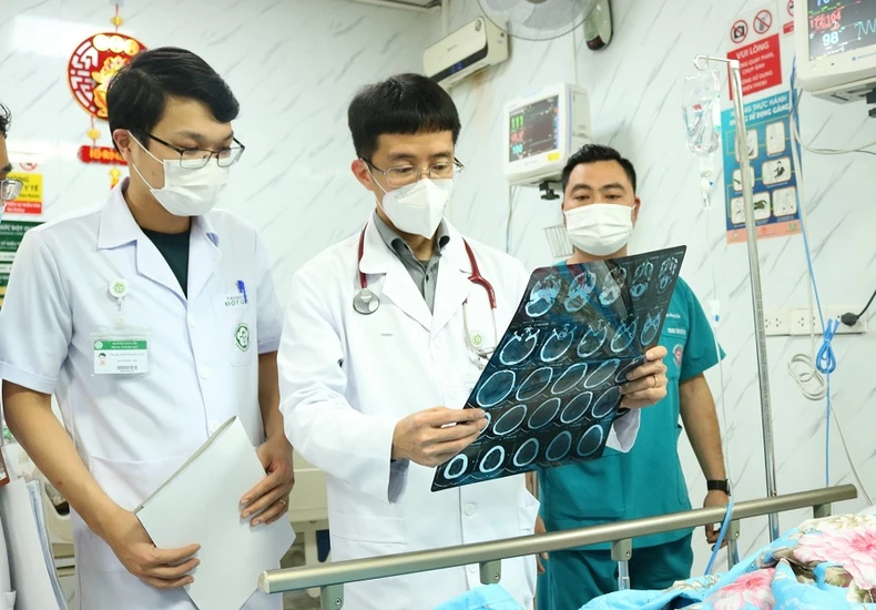 Ngày càng nhiều người trẻ bị đột quỵ ảnh 2