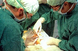 Viện Bỏng Quốc gia phẫu thuật thành công ghép ngón tay cái từ ngón chân
