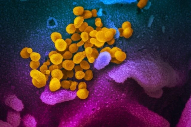 Hình ảnh qua kính hiển vi điện tử cho thấy virus SARS-CoV-2 (màu vàng) được phân lập từ một bệnh nhân, nổi lên từ bề mặt tế bào (màu xanh / hồng) được nuôi cấy trong phòng thí nghiệm. Ảnh: NIAID-RML.