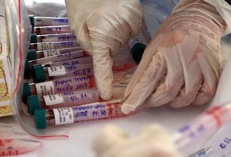 Bộ Y tế ban hành kế hoạch xét nghiệm phát hiện nhiễm SARS-CoV-2 trong tình hình mới