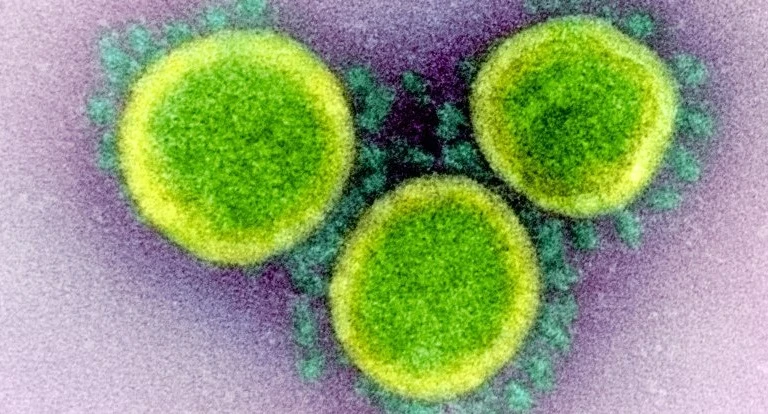 Hình ảnh các hạt virus SARS-CoV-2 qua kính hiển vi điện tử. Ảnh: NIAID.