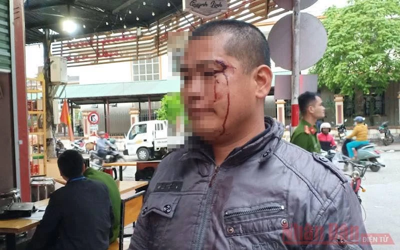 Anh Triệu La Luyện bị đánh gây thương tích, chảy máu vùng mặt.