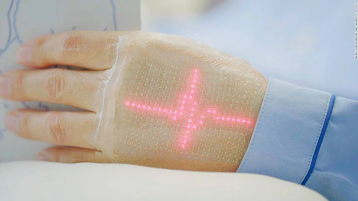 Công nghệ E-skin giúp theo dõi nhịp tim. Ảnh: CNN