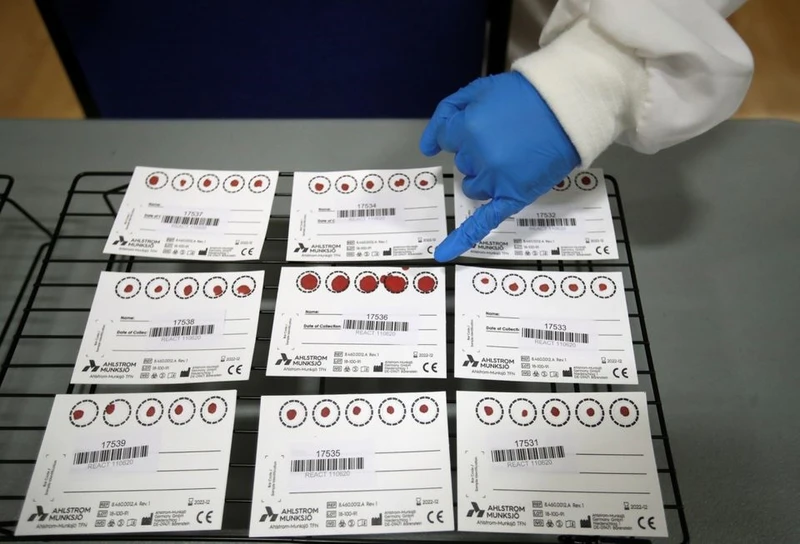Các mẫu máu trong một thử nghiệm lâm sàng về các xét nghiệm đối với kháng thể Covid-19, tại Đại học Keele, ở Keele, Anh vào ngày 30/6/2020. Ảnh: Reuters.