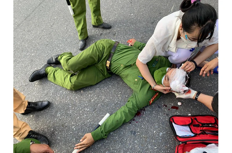 Đại úy Lê Ngọc Dũng bị thương tích nặng sau cú đâm xe của nam sinh viên.