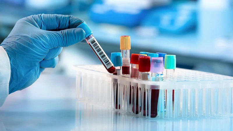 Phương pháp xét nghiệm máu Galleri được cho là có thể giúp phát hiện sớm hơn 50 loại ung thư. (Ảnh minh họa: GHP News)