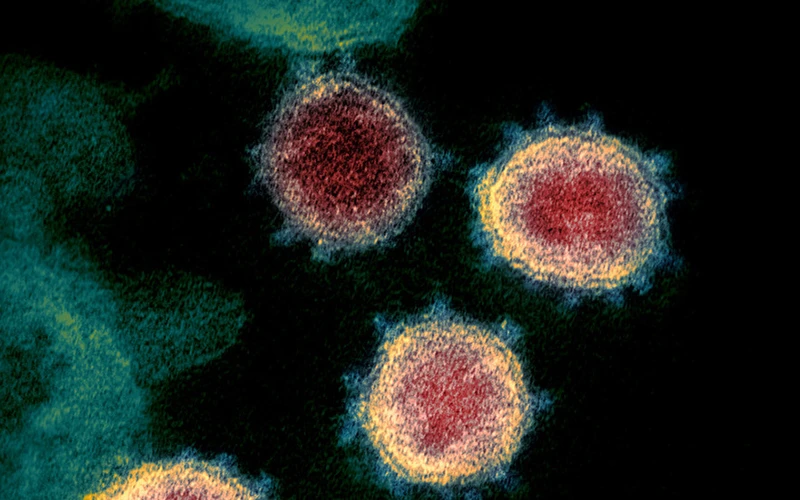 Hình ảnh virus SARS-CoV-2 qua kính hiển vi điện tử. (Ảnh: Reuters)