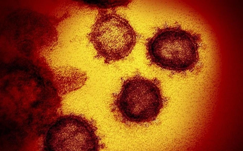 Hình ảnh dưới kính hiển vi do Viện Quốc gia về bệnh truyền nhiễm và dị ứng Mỹ cung cấp cho thấy, virus SARS-CoV-2 được phân lập và xuất hiện trên bề mặt tế bào của 1 bệnh nhân mắc Covid-19 tại Mỹ. (Ảnh: AFP/TTXVN)