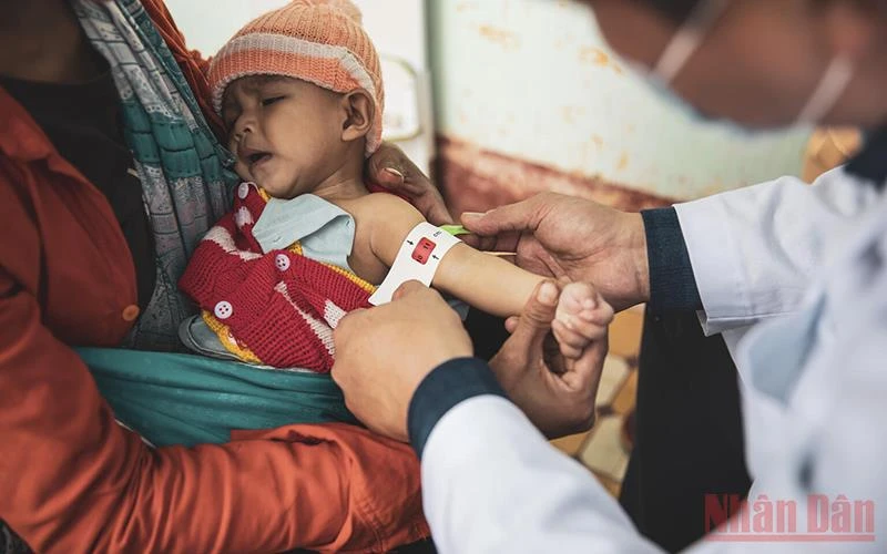 UNICEF kêu gọi cần đẩy mạnh nỗ lực đưa việc điều trị trẻ em suy dinh dưỡng cấp tính vào luật Việt Nam. (Ảnh: UNICEF)