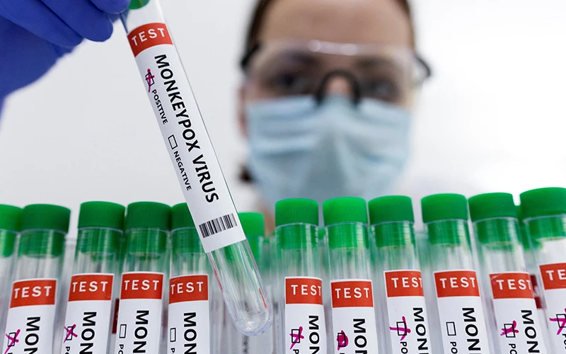 Ống đựng mẫu bệnh phẩm có đánh dấu dương tính với virus gây đậu mùa khỉ. (Ảnh: Reuters)