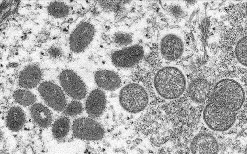 Hình ảnh virus đậu mùa khỉ dưới kính hiển vi điện tử. (Ảnh: AFP/TTXVN)