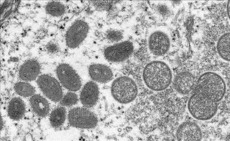 Hình ảnh virus đậu mùa khỉ dưới kính hiển vi điện tử. Ảnh: AFP/TTXVN