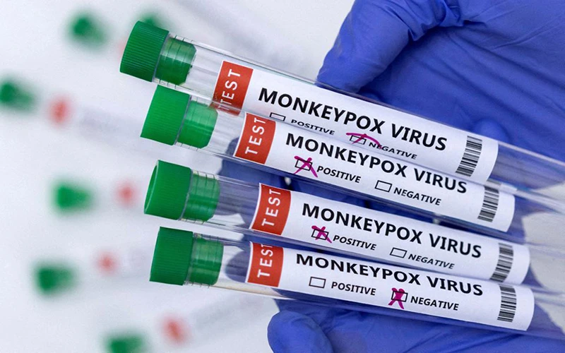 Ống đựng mẫu xét nghiệm dương tính với virus gây bệnh đậu mùa. (Ảnh: Reuters)
