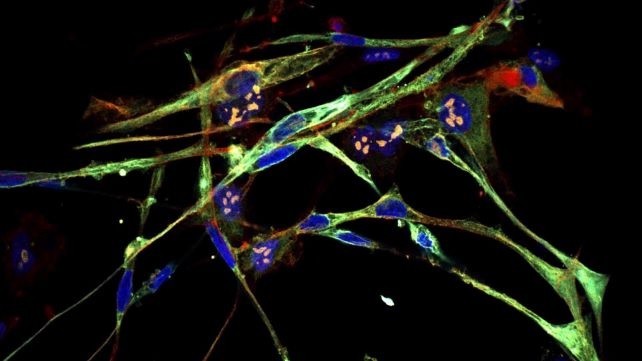 Tế bào Rhabdomyosarcoma biến đổi thành tế bào cơ. Ảnh: Phòng thí nghiệm Cold Spring Harbor.