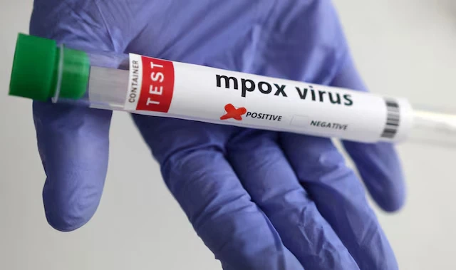 Xét nghiệm virus đậu mùa khỉ. Ảnh: Reuters