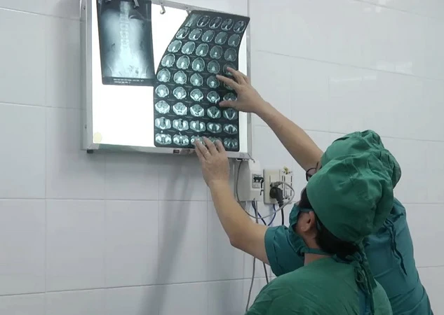 Các bác sĩ theo dõi viên đạn trong người anh Giáp qua phim chụp X-quang.