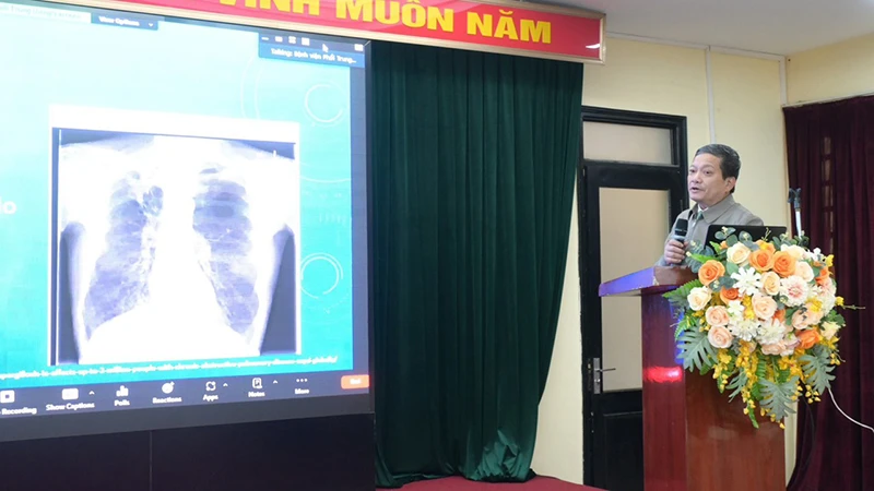 Tiến sĩ, bác sĩ cao cấp Đinh Văn Lượng, Giám đốc Bệnh viện Phổi Trung ương chia sẻ về bệnh nấm phổi.