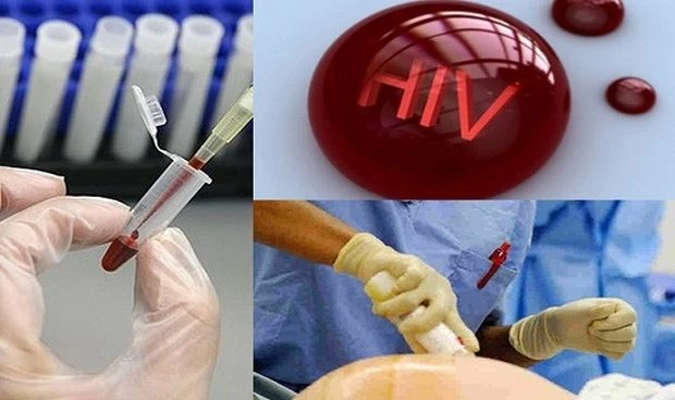 Điều kiện xác định người bị phơi nhiễm HIV, người bị nhiễm HIV do tai nạn rủi ro nghề nghiệp. (Ảnh: chinhphu.vn)