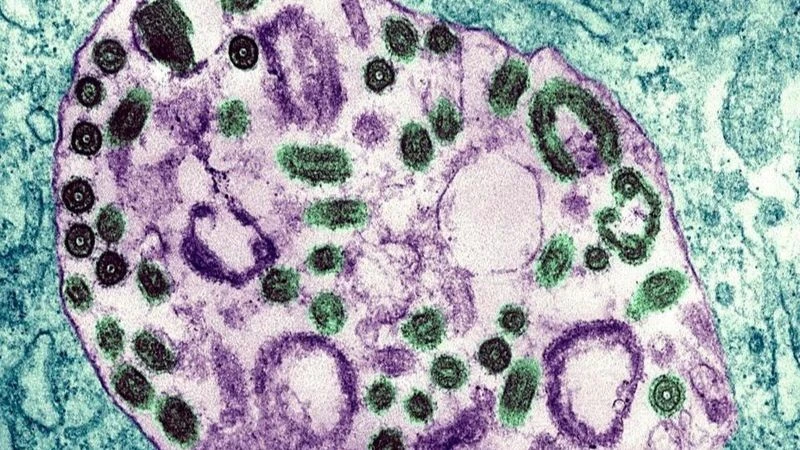 Hình ảnh dưới kính hiển vi điện tử của virus Marburg. (Ảnh: BSIP/UIG/Getty Images)