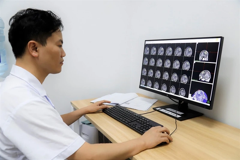 Phương pháp xạ phẫu gamma hiện đại điều trị thành công nhiều trường hợp u não.