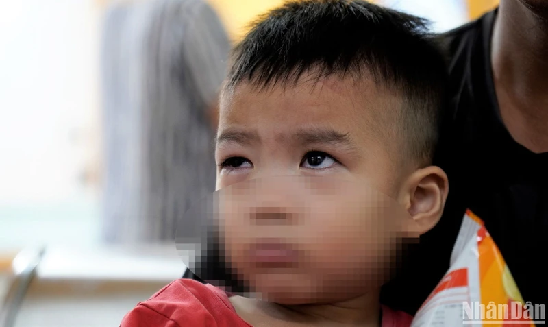Trẻ đau mắt đỏ khám tại Bệnh viện Mắt Trung ương. (Ảnh: THẾ KHẢI)