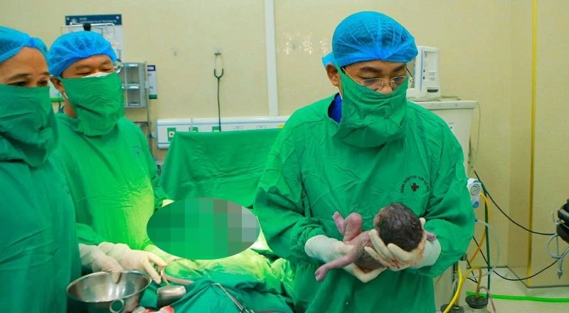 Giáo sư, Tiến sĩ Nguyễn Duy Ánh - Giám đốc Bệnh viện Phụ sản Hà Nội mổ lấy thai cho sản phụ. 