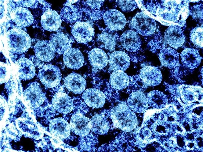 Hình ảnh từ kính hiển vi do Viện nghiên cứu bệnh truyền nhiễm và dị ứng quốc gia Mỹ cung cấp cho thấy virus SARS-CoV-2 trong mẫu bệnh phẩm của bệnh nhân mắc Covid-19. (Ảnh minh họa: AFP/TTXVN)
