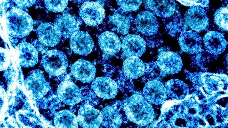 Virus SARS-CoV-2. (Ảnh: AFP/TTXVN)