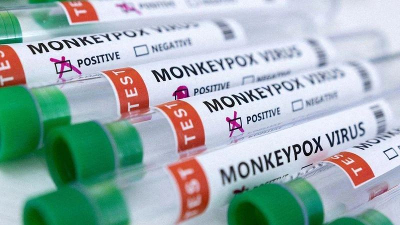 Ống đựng bệnh phẩm dương tính với đậu mùa khỉ. (Ảnh: Reuters)