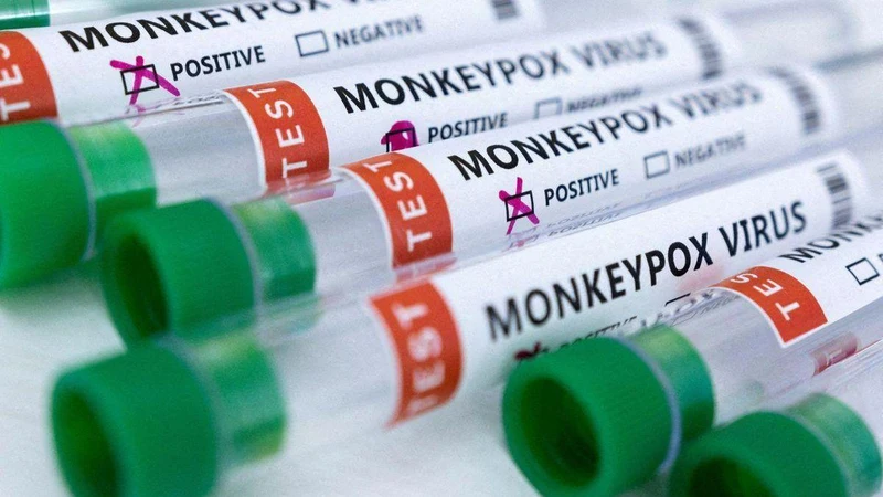 Ống đựng mẫu bệnh phẩm dương tính với đậu mùa khỉ. (Ảnh: Reuters)