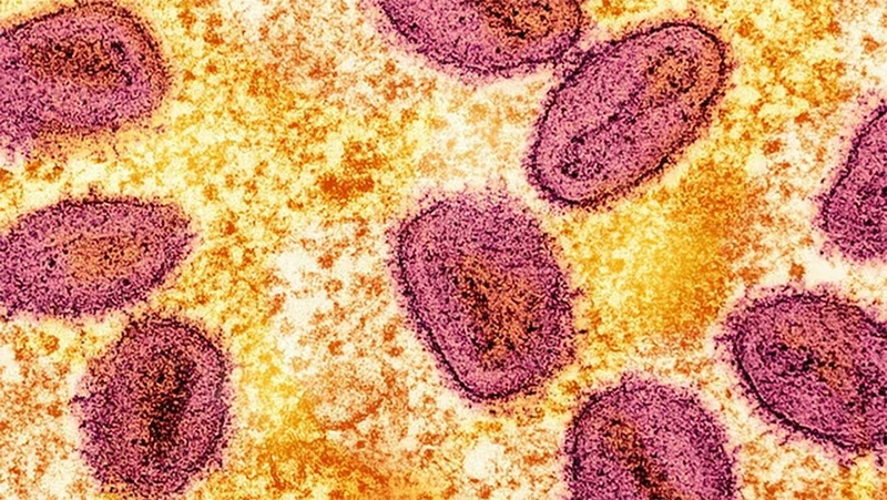 Virus đậu mùa khỉ. (Ảnh: Reuters)